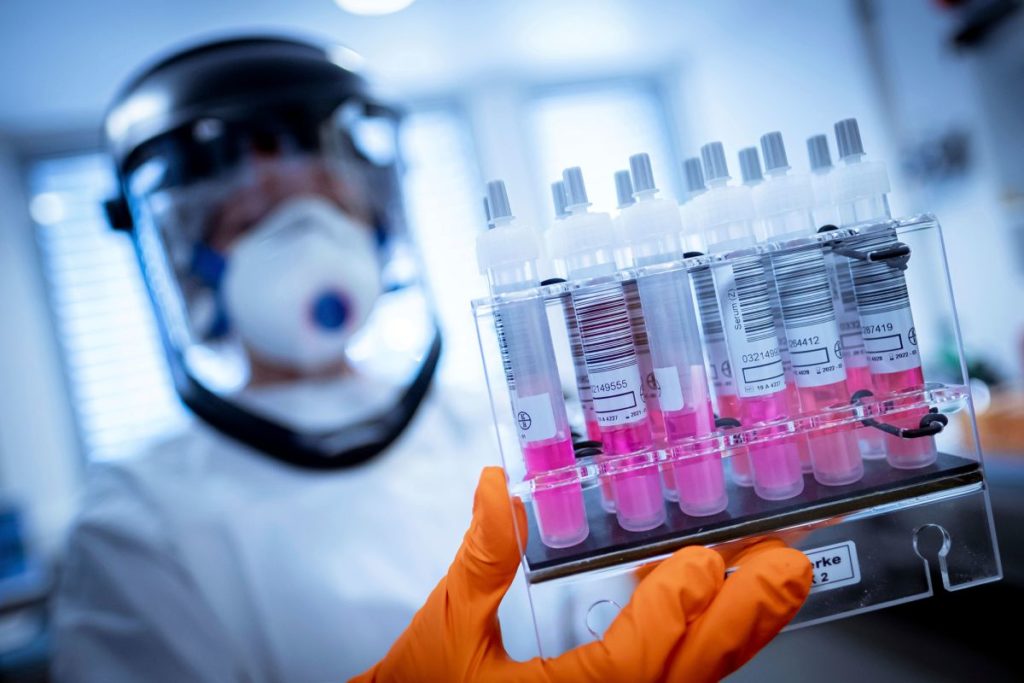 عقار «Leronlimab» لعلاج الإيدز يدخل مرحلة التجارب لمواجهة كورونا عقار «Leronlimab»