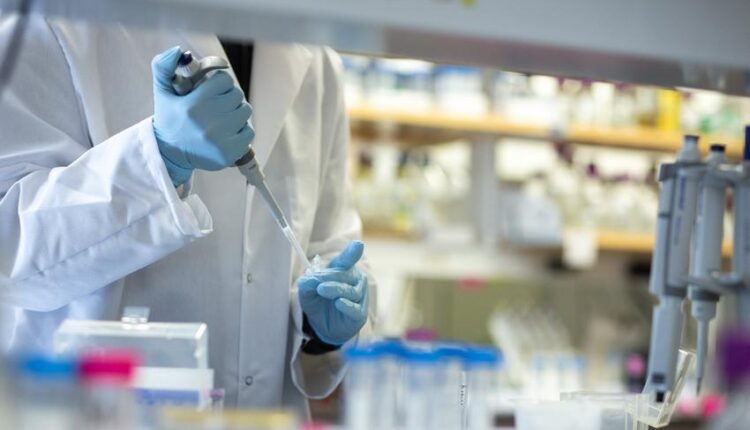 اختبار تشخيصي لكورونا