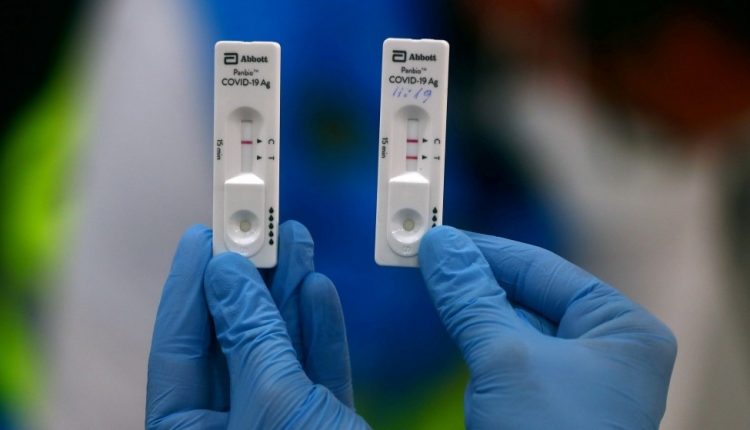 اختبار للكشف عن فيروس كورونا من شركة أبوت