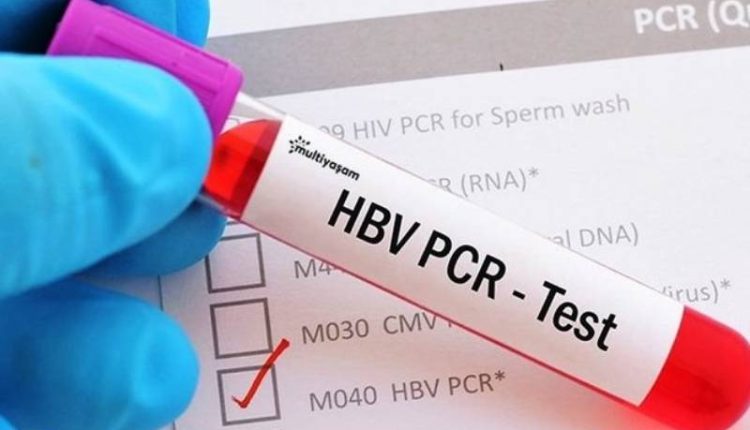 تحاليل كورونا pcr