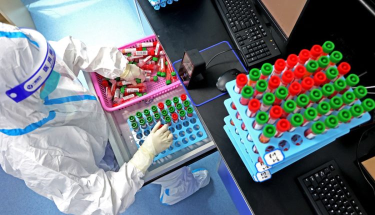 اختبارات كورونا