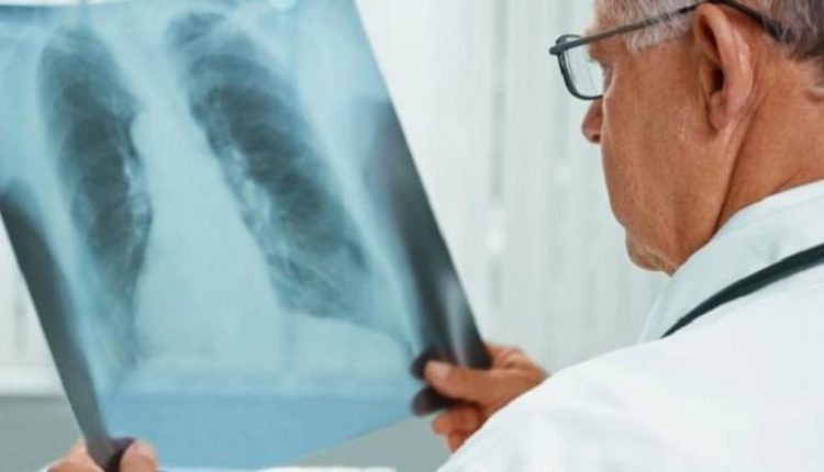 التهاب رئوي غامض