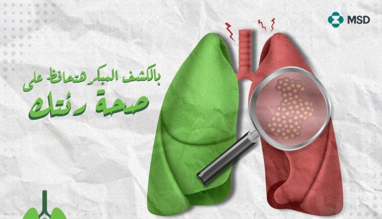«إم إس دي» تطلق حملة «رئتك مفتاح حياتك» في الشهر العالمي للتوعية بسرطان الرئة