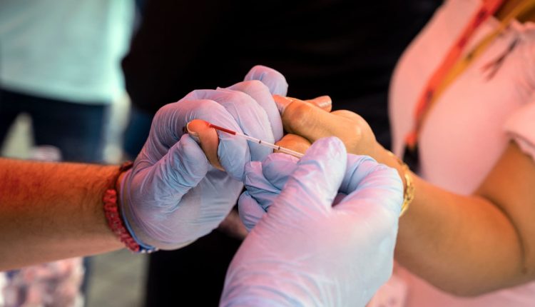 لقاح تجريبي مضاد لمرض الإيدز