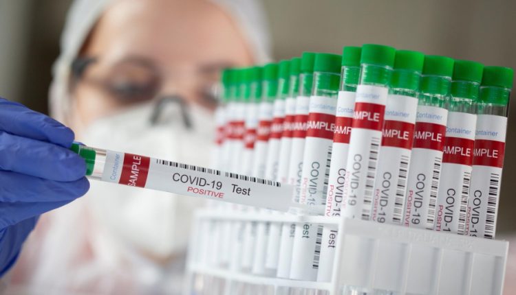 متحور أوميكرون الجديد