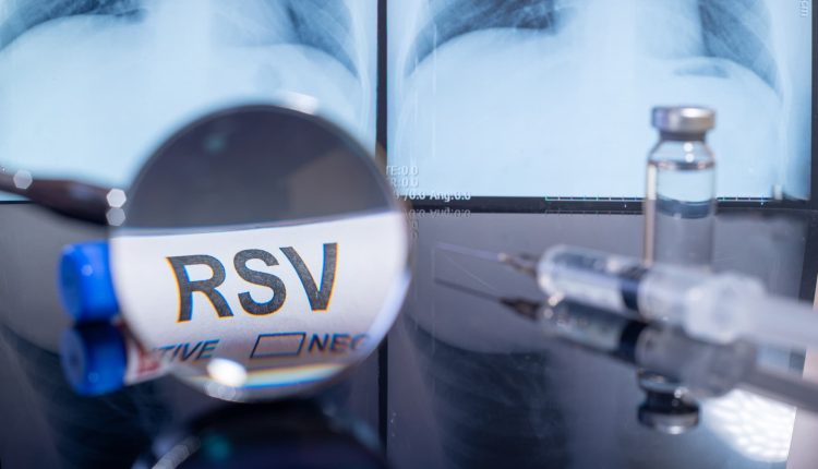 لقاح الفيروس المخلوي التنفسي