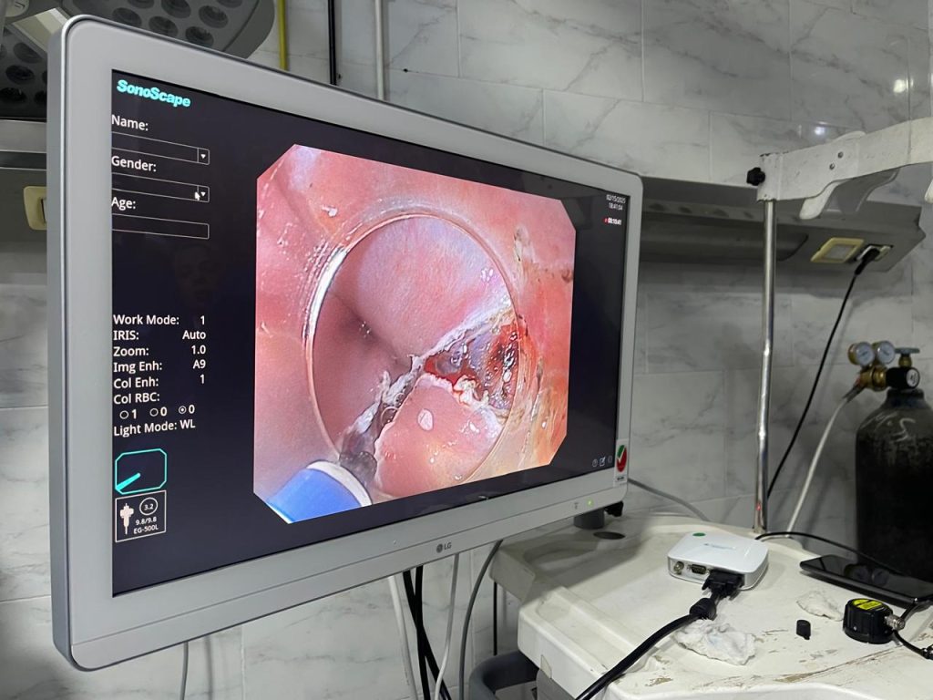 «الصحة»: نجاح الطاقم الطبي بمستشفى منيا القمح المركزي في إجراء تدخلات متطورة بتقنية الفراغ الثالث